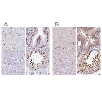 Anti-DR1 antibody produced in rabbit Prestige Antibodies&#174; Powered by Atlas Antibodies, affinity isolated antibody, buffered aqueous glycerol solution