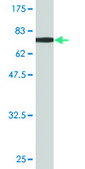 Monoclonal Anti-ACY1 antibody produced in mouse clone 1A11-F6, purified immunoglobulin, buffered aqueous solution