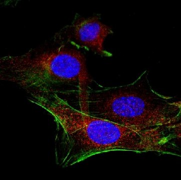 Anti-PDGFR Beta Antibody from rabbit, purified by affinity chromatography