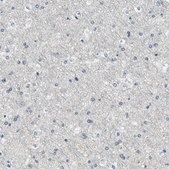 Anti-MYO1G antibody produced in rabbit Prestige Antibodies® Powered by Atlas Antibodies, affinity isolated antibody, buffered aqueous glycerol solution