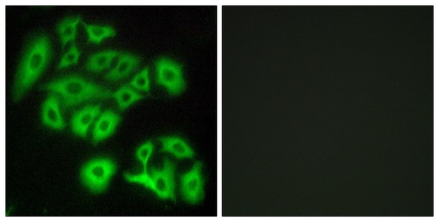 Anti-FZD4 antibody produced in rabbit affinity isolated antibody