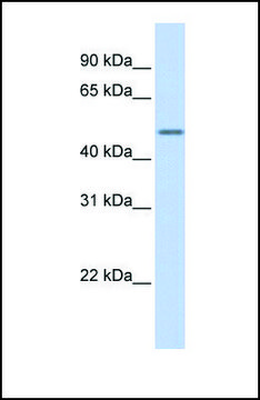 Anti-KRT16 antibody produced in rabbit affinity isolated antibody