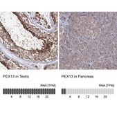 Anti-PEX13 antibody produced in rabbit Prestige Antibodies® Powered by Atlas Antibodies, affinity isolated antibody, buffered aqueous glycerol solution
