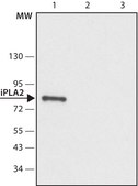 Anti-Phospholipase A2 (iPLA2) (C-terminal region) antibody produced in rabbit ~1.5 mg/mL, affinity isolated antibody