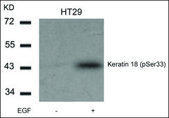 Anti-phospho-KRT18 (pSer33) antibody produced in rabbit affinity isolated antibody