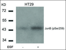 Anti-phospho-JUNB (pSer259) antibody produced in rabbit affinity isolated antibody