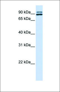 Anti-PCSK6 affinity isolated antibody