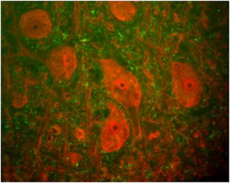 Anti-UCHL1 Antibody, clone MCA-BH7 clone MCA-BH7, from mouse