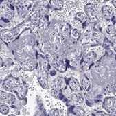 Anti-DSC1 Prestige Antibodies® Powered by Atlas Antibodies, affinity isolated antibody