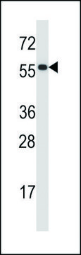 ANTI-PDIA2 (CENTER) antibody produced in rabbit IgG fraction of antiserum, buffered aqueous solution