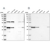 Anti-PRKRA antibody produced in rabbit Prestige Antibodies® Powered by Atlas Antibodies, affinity isolated antibody