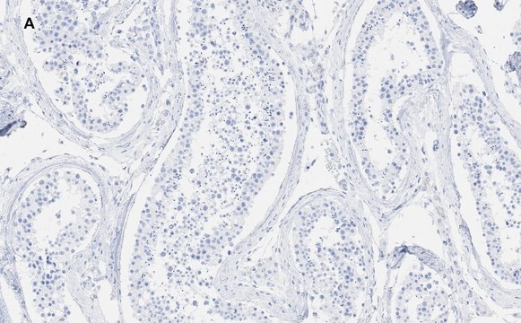 Anti-GAPDH Antibody, clone 10B13, ZooMAb&#174; Rabbit Monoclonal recombinant, expressed in HEK 293 cells