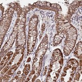 Anti-ATAD3B antibody produced in rabbit Prestige Antibodies® Powered by Atlas Antibodies, affinity isolated antibody, buffered aqueous glycerol solution