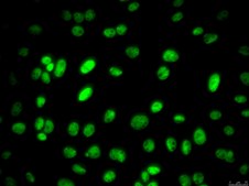 PyMT-1099 Mouse Mammary Tumor EMT Model Cell Line