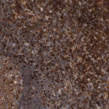 Anti-PRKCH antibody produced in rabbit Prestige Antibodies&#174; Powered by Atlas Antibodies, affinity isolated antibody, buffered aqueous glycerol solution