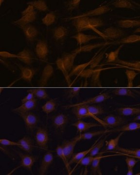 Anti-TIMP2 antibody produced in rabbit