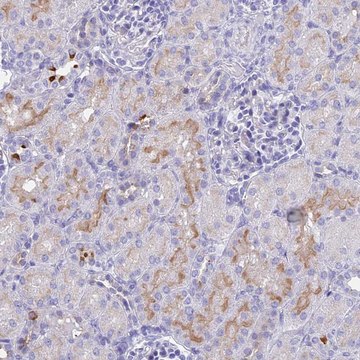 Anti-TMEM161B antibody produced in rabbit Prestige Antibodies&#174; Powered by Atlas Antibodies, affinity isolated antibody, buffered aqueous glycerol solution