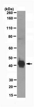 Anti-phospho-SMAD3 (Tyr179) Antibody from rabbit, purified by affinity chromatography