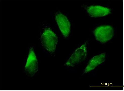 Anti-SERPINH1 antibody produced in mouse purified immunoglobulin, buffered aqueous solution