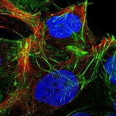 Anti-CYP20A1 antibody produced in rabbit Prestige Antibodies® Powered by Atlas Antibodies, affinity isolated antibody, buffered aqueous glycerol solution