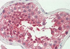 Anti-BCKDK antibody produced in rabbit affinity isolated antibody