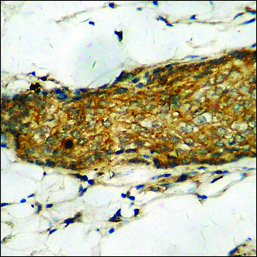 Anti-phospho-GRK1 (pSer21) antibody produced in rabbit affinity isolated antibody