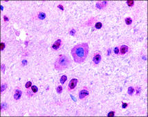 Anti-GLI2 antibody produced in rabbit affinity isolated antibody, buffered aqueous solution