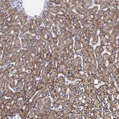 Anti-ACADSB antibody produced in rabbit Prestige Antibodies® Powered by Atlas Antibodies, affinity isolated antibody, buffered aqueous glycerol solution