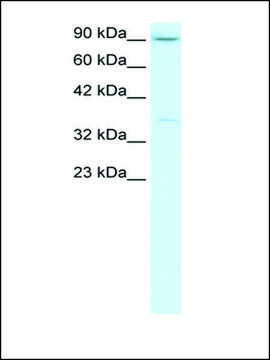 Anti-TBP from hog kidney IgG fraction of antiserum