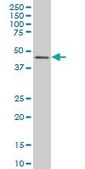 Monoclonal Anti-IRF2 antibody produced in mouse clone 3D6, purified immunoglobulin, buffered aqueous solution