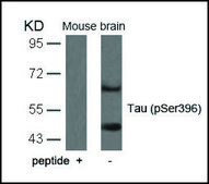 Anti-phospho-MAPT (pSer396) antibody produced in rabbit affinity isolated antibody