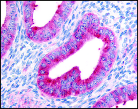 Anti-FAP (AB1) antibody produced in rabbit affinity isolated antibody, buffered aqueous solution