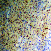 Anti-phospho-p53 (pSer15) antibody produced in rabbit affinity isolated antibody