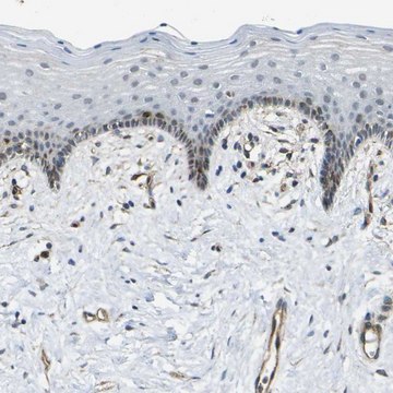 Anti-ECE1 antibody produced in rabbit Prestige Antibodies&#174; Powered by Atlas Antibodies, affinity isolated antibody, buffered aqueous glycerol solution