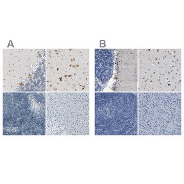 Anti-B4GALNT1 antibody produced in rabbit Ab1, Prestige Antibodies&#174; Powered by Atlas Antibodies, affinity isolated antibody, buffered aqueous glycerol solution