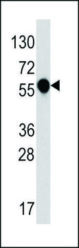 ANTI-IL1R (C-TERM E487) antibody produced in rabbit IgG fraction of antiserum, buffered aqueous solution