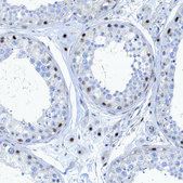 Anti-CAMTA1 antibody produced in rabbit Prestige Antibodies® Powered by Atlas Antibodies, affinity isolated antibody, buffered aqueous glycerol solution