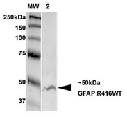 Monoclonal Anti-Lrrk2/Dardarin - Apc antibody produced in mouse clone S231B-34, purified immunoglobulin