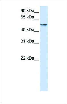 抗 USP22 (ab2) 兔抗 affinity isolated antibody