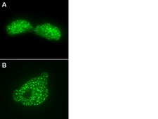 LentiBrite GFP-Rad51 Lentiviral Biosensor