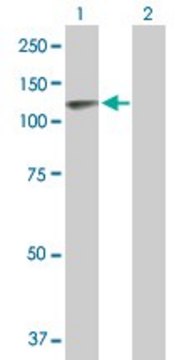 Anti-TPO antibody produced in mouse purified immunoglobulin, buffered aqueous solution