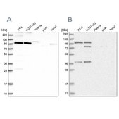 Anti-CMTR1 antibody produced in rabbit Prestige Antibodies® Powered by Atlas Antibodies, affinity isolated antibody, buffered aqueous glycerol solution