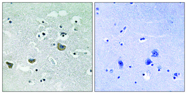 抗 SREBP-1 兔抗 affinity isolated antibody