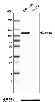 Anti-AMPD2 antibody produced in rabbit Prestige Antibodies&#174; Powered by Atlas Antibodies, affinity isolated antibody, buffered aqueous glycerol solution