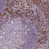 Monoclonal Anti-S100A4 antibody produced in mouse Prestige Antibodies® Powered by Atlas Antibodies, clone CL0240, purified immunoglobulin, buffered aqueous glycerol solution