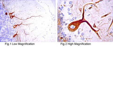 Anti-IP3 Receptor 1 Antibody serum, from rabbit