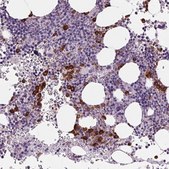 Anti-MPO antibody produced in rabbit Prestige Antibodies® Powered by Atlas Antibodies, affinity isolated antibody, buffered aqueous glycerol solution