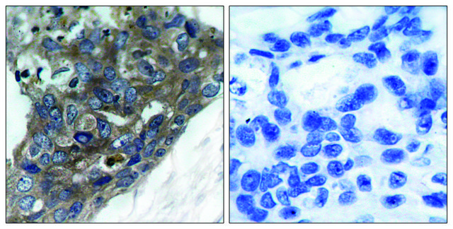 Anti-ASK1 antibody produced in rabbit affinity isolated antibody