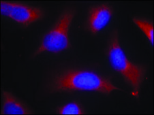 Anti-phospho-MAPT (pSer262) antibody produced in rabbit affinity isolated antibody