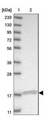 Anti-SRP19 antibody produced in rabbit Prestige Antibodies® Powered by Atlas Antibodies, affinity isolated antibody, buffered aqueous glycerol solution